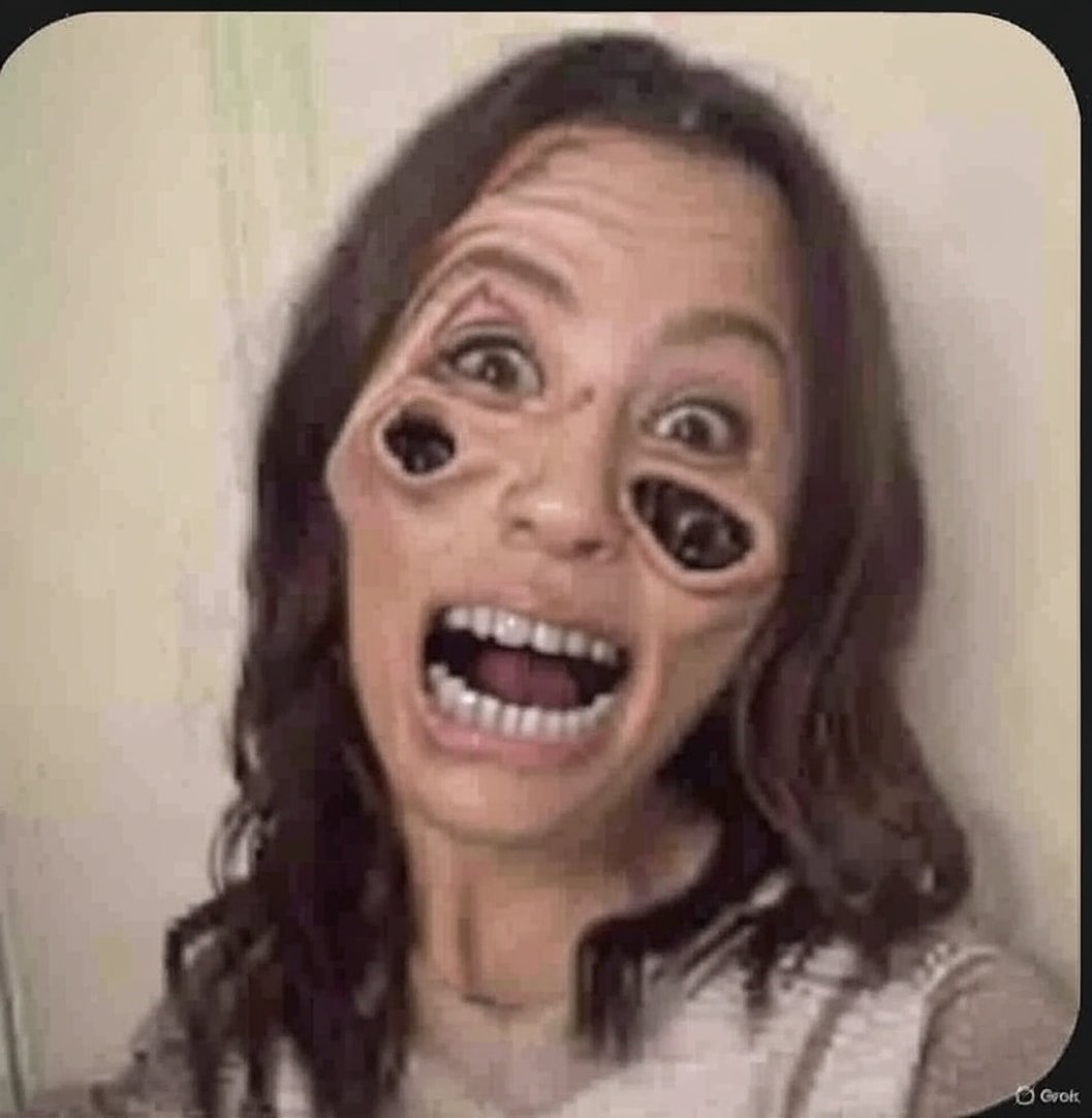 CartierClass's tweet image. #WOACB under a light that shows how far her infection in her face is! #Infected #GrokImage