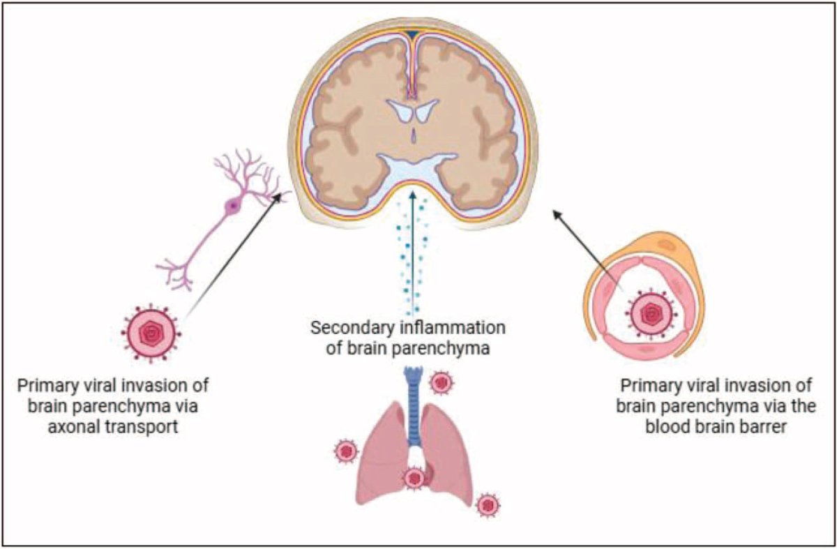 Professor Benedict D Michael MBChB, FRCP, PhD (@benedictneuro) on Twitter photo #Viral #encephalitis – Update on pathogenesis and treatment. OUT NOW in Curr Opin #Neurology:
journals.lww.com/co-neurology/f…
<a href="/BrainIIGroup/">Brain Infection & Inflammation Group</a> <a href="/nhsUHLG/">NHS University Hospitals of Liverpool Group</a> <a href="/LivUni/">University of Liverpool</a> <a href="/_brendan95/">Brendan Sargent</a> @melibeus <a href="/covidcns/">@covidcns</a> <a href="/WaltonCentre/">The Walton Centre</a> #Viral #encephalitis – Update on pathogenesis and treatment. OUT NOW in Curr Opin #Neurology:
journals.lww.com/co-neurology/f…
<a href="/BrainIIGroup/">Brain Infection & Inflammation Group</a> <a href="/nhsUHLG/">NHS University Hospitals of Liverpool Group</a> <a href="/LivUni/">University of Liverpool</a> <a href="/_brendan95/">Brendan Sargent</a> @melibeus <a href="/covidcns/">@covidcns</a> <a href="/WaltonCentre/">The Walton Centre</a>