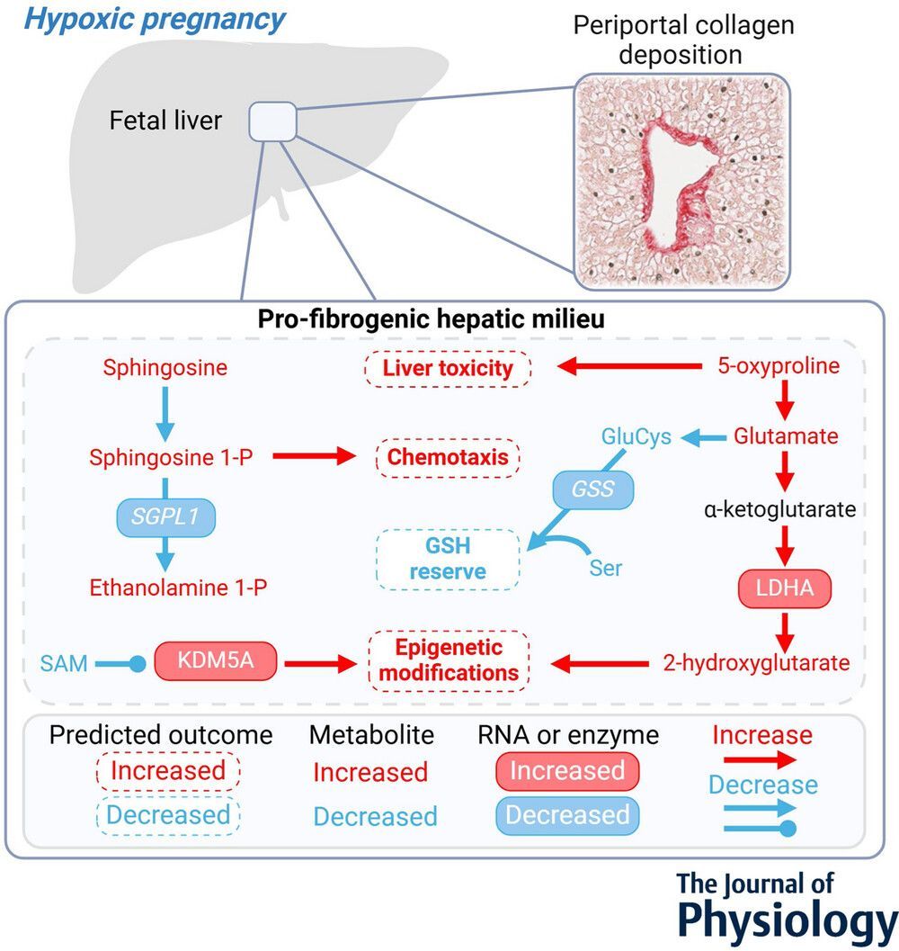 Journal of Physiology (@jphysiol) on Twitter photo Molly M. McGuckin (<a href="/CUAnschutz/">CU Anschutz Medical Campus</a>) et al. found that hypoxic pregnancy promotes #fibrosis and increases stress #metabolites in the ovine fetal liver 🔍 🔗
📜 Read the #Research here: buff.ly/t8tkhkT Molly M. McGuckin (<a href="/CUAnschutz/">CU Anschutz Medical Campus</a>) et al. found that hypoxic pregnancy promotes #fibrosis and increases stress #metabolites in the ovine fetal liver 🔍 🔗
📜 Read the #Research here: buff.ly/t8tkhkT