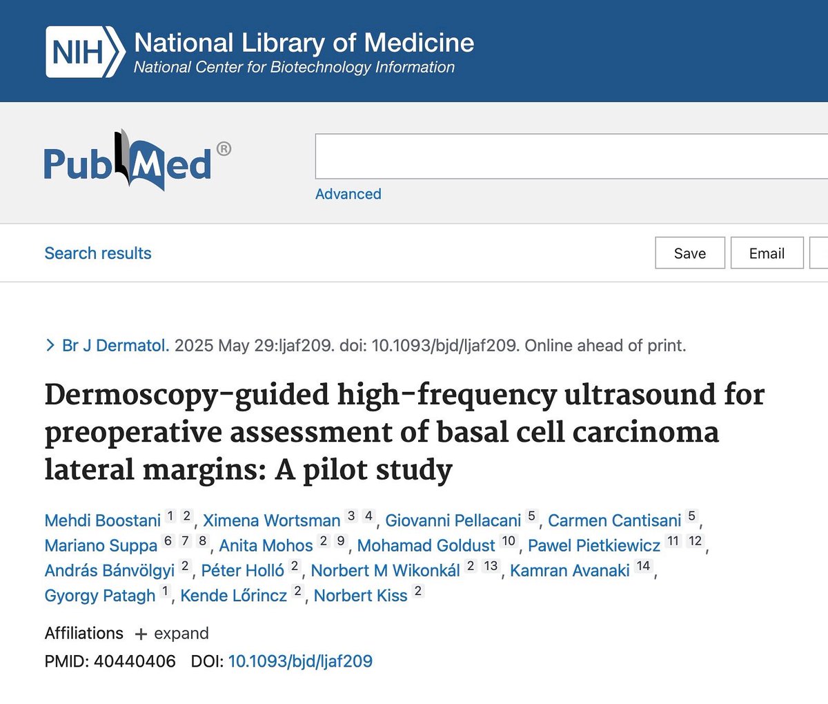 Great news just published: A Fusion of Imaging Technologies: Dermoscopy and High Frequency Ultrasound!
“Dermoscopy-guided high-frequency ultrasound for preoperative assessment of basal cell carcinoma lateral margins” in the British Journal of Dermatology.
📌 This pilot study