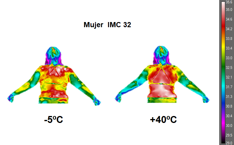 idisalud's tweet image. Ascires participa en el proyecto #FITME, un nuevo modelo personalizado que evalúa de forma integral a los pacientes con obesidad, con el objetivo de generar un procedimiento ágil, sostenible y no invasivo que supere las limitaciones diagnósticas actuales.

Gracias Ascires por