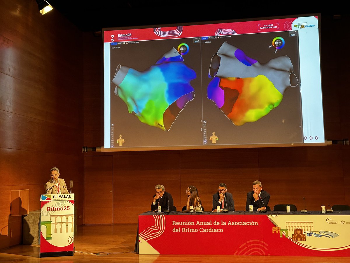 Cristina Lozano (@cris_lozano) on Twitter photo ¿Qué nos queda por aprender del flutter atípico ⚡️? ¡Muchas cosas 🤓! Excelente sesión con <a href="/EduFrancoDiez/">Eduardo Franco Díez</a> como ponente y el Dr. Matía como co-moderador. Felices de contribuir con nuestra experiencia en este interesantísimo sustrato <a href="/Arritmias_HRC/">Arritmias H. Ramón y Cajal, Madrid.</a> <a href="/cardioRyC/">Cardiología H. U. Ramón y Cajal, Madrid</a> #ritmo25 ¿Qué nos queda por aprender del flutter atípico ⚡️? ¡Muchas cosas 🤓! Excelente sesión con <a href="/EduFrancoDiez/">Eduardo Franco Díez</a> como ponente y el Dr. Matía como co-moderador. Felices de contribuir con nuestra experiencia en este interesantísimo sustrato <a href="/Arritmias_HRC/">Arritmias H. Ramón y Cajal, Madrid.</a> <a href="/cardioRyC/">Cardiología H. U. Ramón y Cajal, Madrid</a> #ritmo25