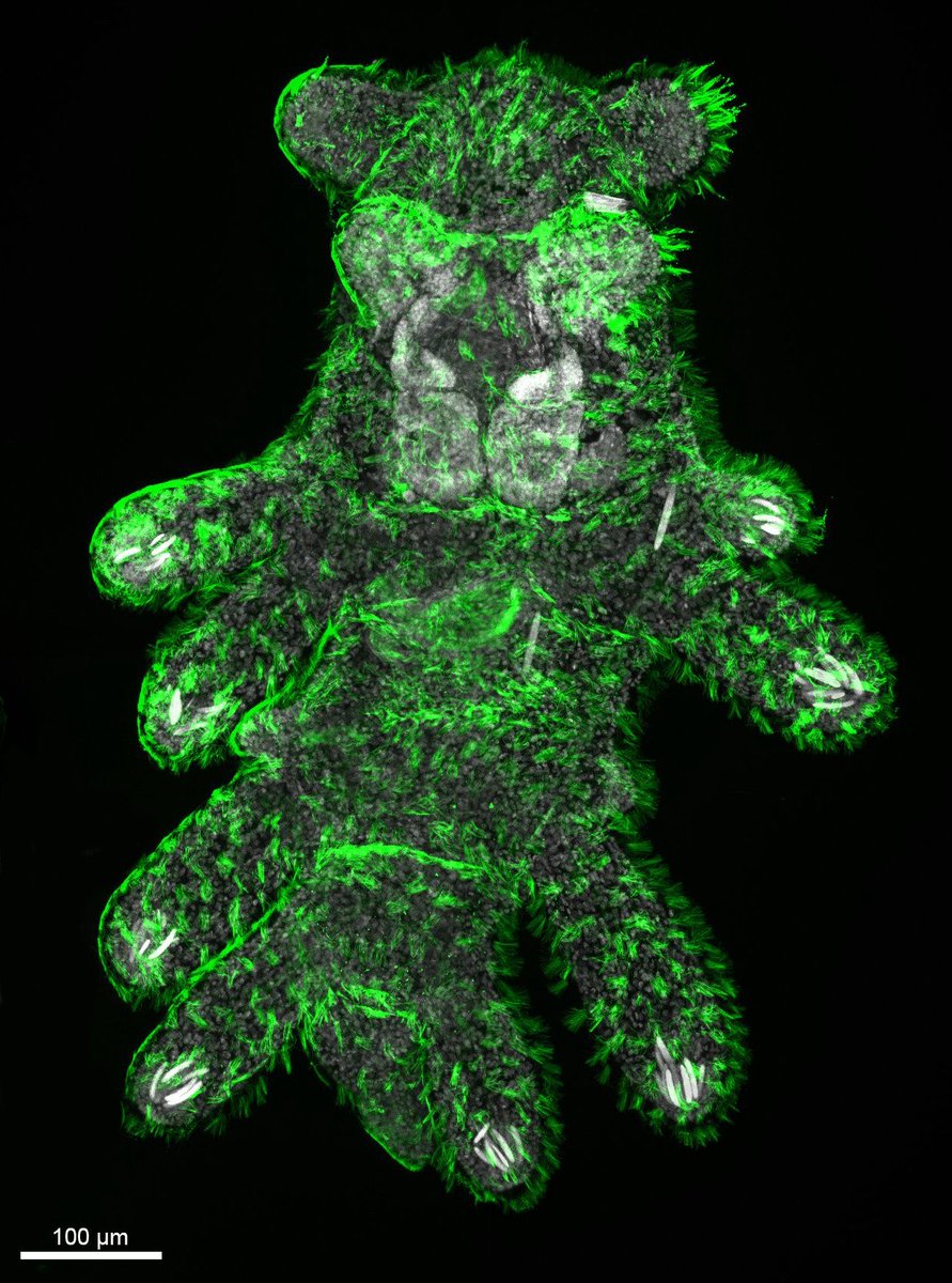 Society for Developmental Biology (@socdevbio) on Twitter photo ✨#FluorescenceFriday brings you a glowing Berghia stephanieae juvenile! This stunning sea slug is lit up with Anti-α-Tubulin 🟢, revealing the dense network of cilia that help it glide across surfaces. 🐌💫 Image taken by <a href="/Luiza_O_Saad/">Luiza Saad</a>
#Microscopy #DevBio ✨#FluorescenceFriday brings you a glowing Berghia stephanieae juvenile! This stunning sea slug is lit up with Anti-α-Tubulin 🟢, revealing the dense network of cilia that help it glide across surfaces. 🐌💫 Image taken by <a href="/Luiza_O_Saad/">Luiza Saad</a>
#Microscopy #DevBio
