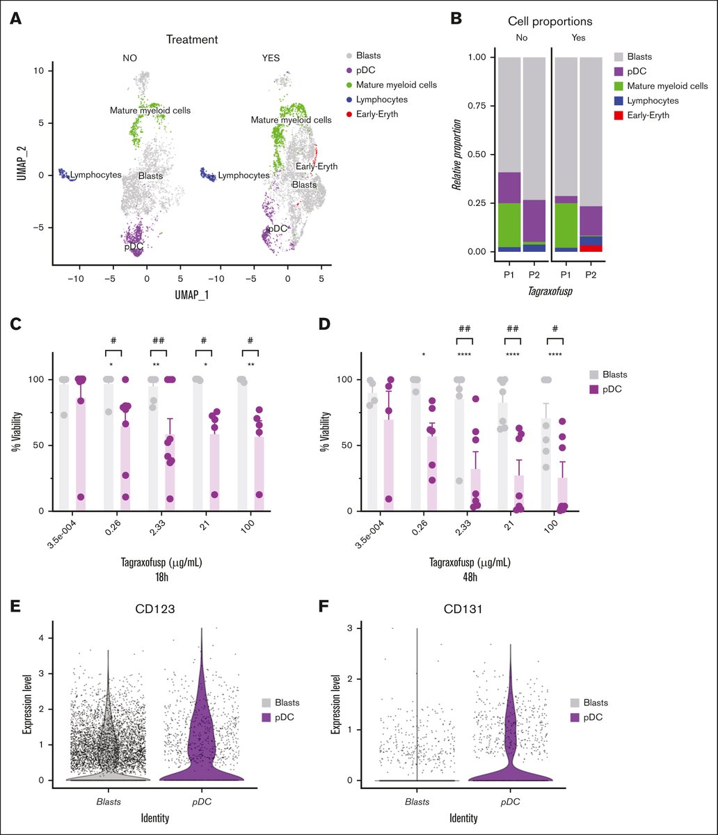 Bloodneoplasia's tweet image. pDC-AML have a distinct immune signature compared to blastic plasmacytoid dendritic cell neoplasm with CD56low and TdThigh/CD34high expression. ow.ly/GfrQ50VVSXr #myeloidneoplasia