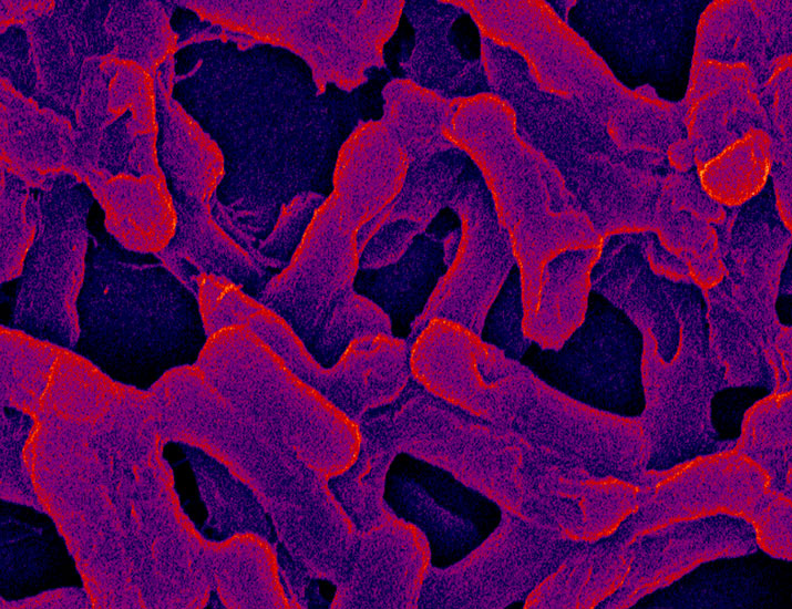 A team has designed a host defense peptide–mimicking prodrug that attacks drug-resistant Gram-negative bacteria at the infection site, decreasing the odds of treatment resistance and showing potency in five mouse models of bacterial infections. scim.ag/4jwPVGt