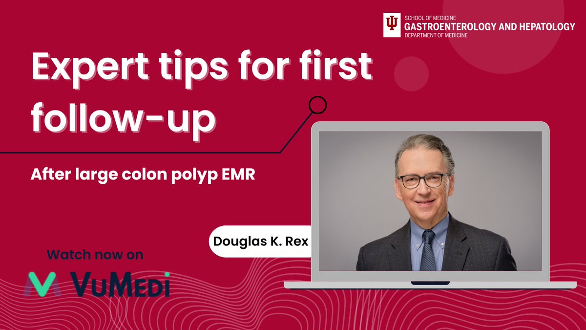 Indiana University Gastroenterology and Hepatology (@iugastro) on Twitter photo 🎥 Learn from an expert!
<a href="/Rex_colonoscopy/">Douglas K. Rex, MD</a> shares expert tips on approach to first follow-up exam after #EMR of a large colorectal polyp.
📲Watch now on @Vumedi: ow.ly/4g5550W1T9n
#IUEndoscopy #Colonoscopy #GITwitter 🎥 Learn from an expert!
<a href="/Rex_colonoscopy/">Douglas K. Rex, MD</a> shares expert tips on approach to first follow-up exam after #EMR of a large colorectal polyp.
📲Watch now on @Vumedi: ow.ly/4g5550W1T9n
#IUEndoscopy #Colonoscopy #GITwitter