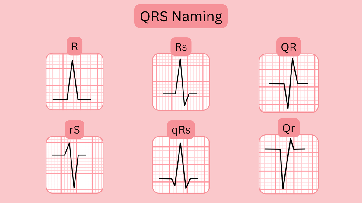 ECGsmart tweet media
