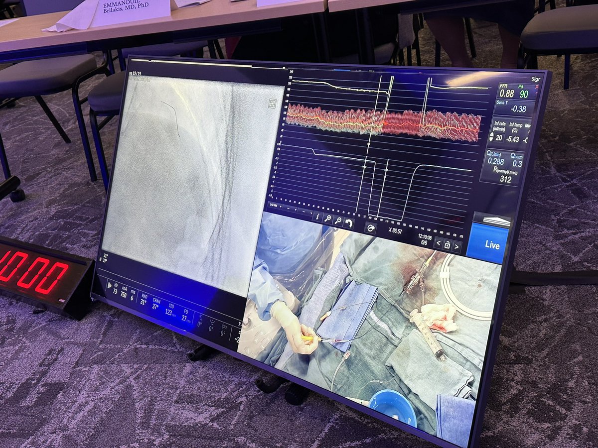 R. Jay Widmer (@drargyle) on Twitter photo Great continuous thermodilution case by <a href="/yadersandoval/">Yader Sandoval</a> <a href="/MHIF_Heart/">Minneapolis Heart Institute Foundation</a> #PhysiologyFirst ! Great continuous thermodilution case by <a href="/yadersandoval/">Yader Sandoval</a> <a href="/MHIF_Heart/">Minneapolis Heart Institute Foundation</a> #PhysiologyFirst !