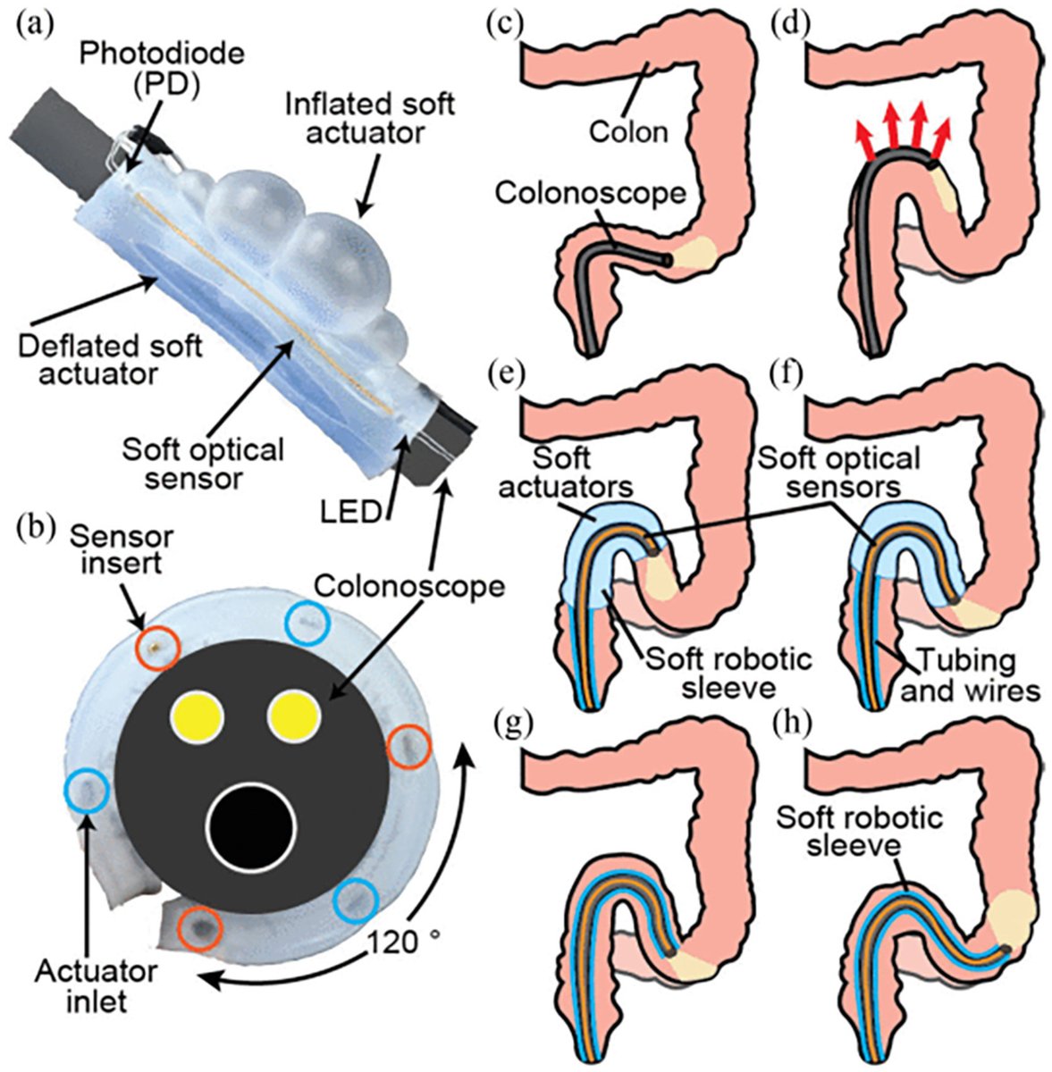 TIGE (@aga_tige) on Twitter photo βοΈ Read our most cited article (from the last 3 years) now π
π Current Engineering Developments for Robotic Systems in Flexible Endoscopy
π ow.ly/zSKB50W1QVa βοΈ Read our most cited article (from the last 3 years) now π
π Current Engineering Developments for Robotic Systems in Flexible Endoscopy
π ow.ly/zSKB50W1QVa