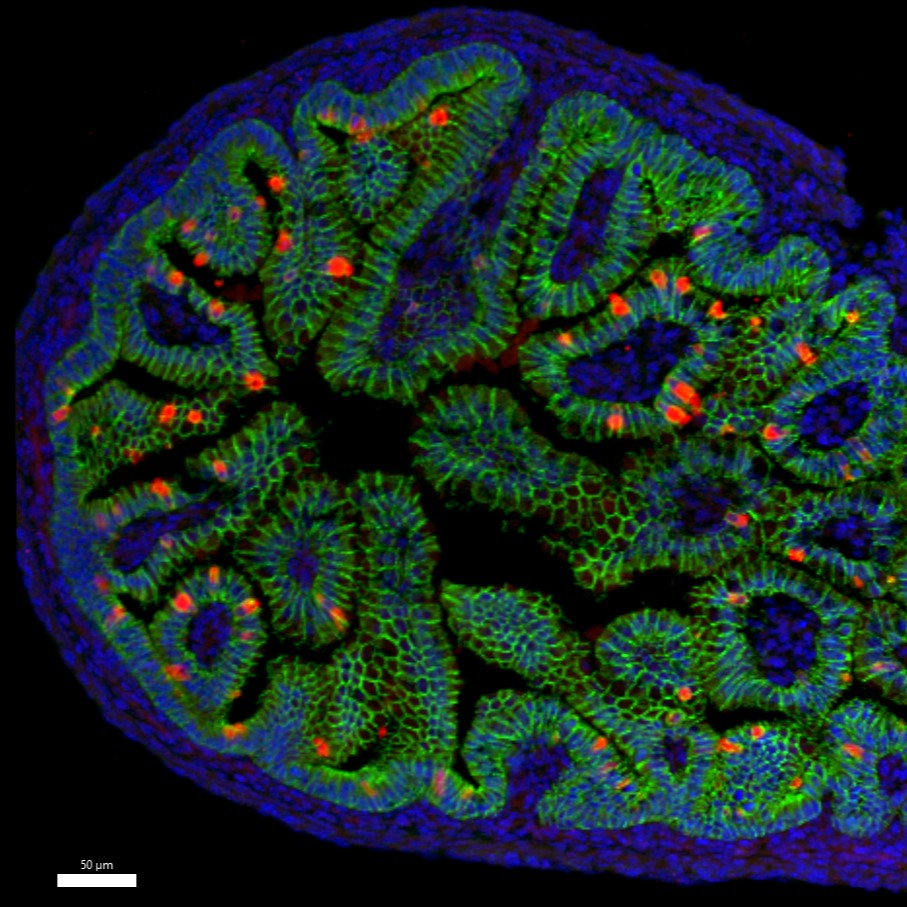 e16.5 mouse duodenum stained for CDH1 (green) and MUC2 (red) #FluorescenceFriday #bioart #cellbiology #endoderm