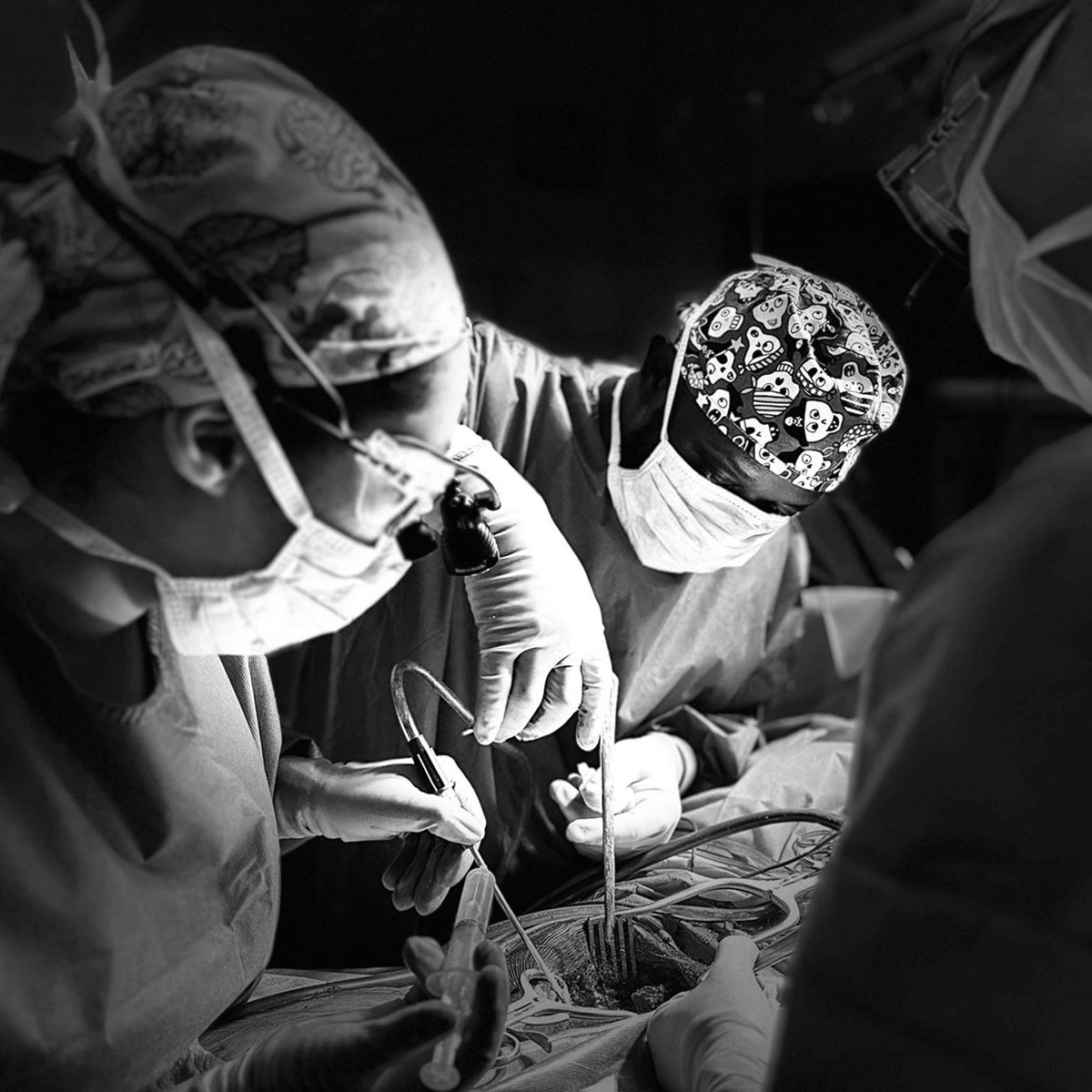 missionbrainorg's tweet image. The future of neurosurgery in Sierra Leone is bright.
This past week marked the official launch at Connaught Hospital—years of training, teamwork, and partnership made it possible.
We’re just getting started.
#MissionBRAIN #SierraLeone #GlobalNeurosurgery #BuildingBridges