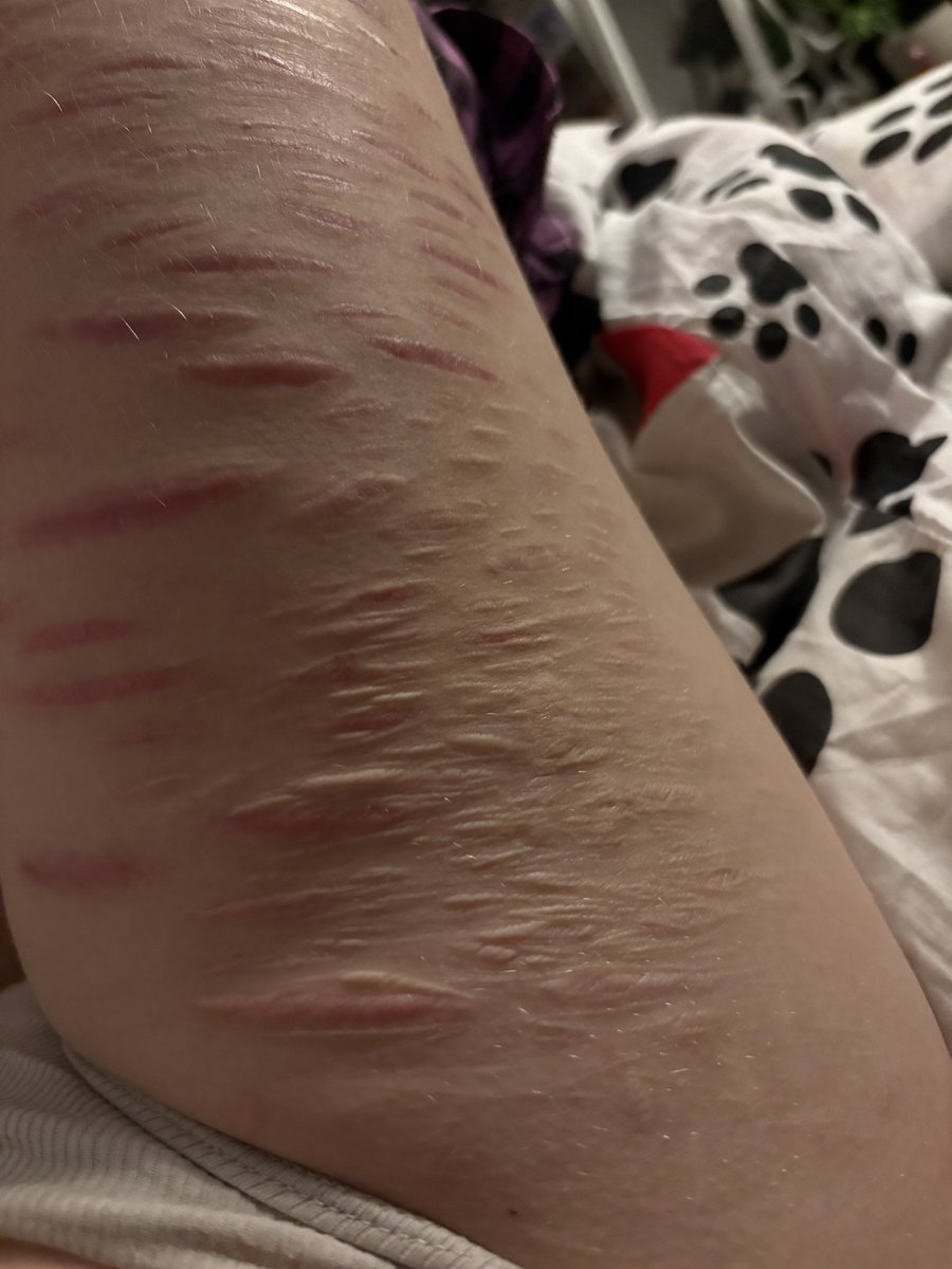 i like and hate my scarz