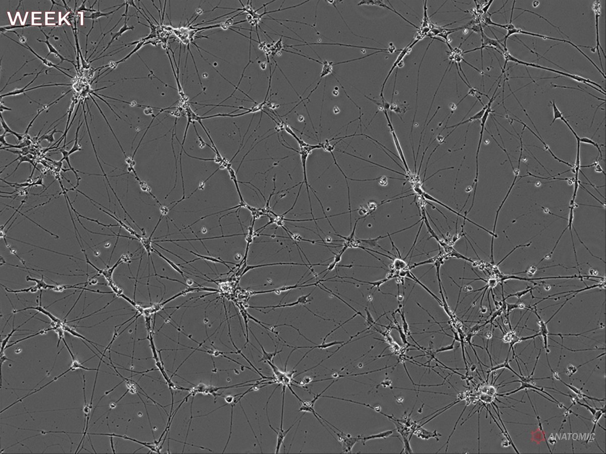 AnatomicTech's tweet image. Motor neurons alone can&apos;t explain ALS or CMT. Schwann Cell Precursors reveal how disrupted glial-neuronal crosstalk drives disease. Co-cultures model early pathogenesis, glial dysfunction, and myelination defects more accurately

#CompleteTheCircuit #NotYourAverageNeuron