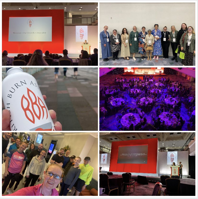 Nicole Lee (@burns_nicolelee) on Twitter photo Just home after fantastic <a href="/BritishBurn/">British Burn Assoc.</a> conference brain full of projects and ideas 😊 but now time to catch up on sleep 💤 😴🛏️ Just home after fantastic <a href="/BritishBurn/">British Burn Assoc.</a> conference brain full of projects and ideas 😊 but now time to catch up on sleep 💤 😴🛏️