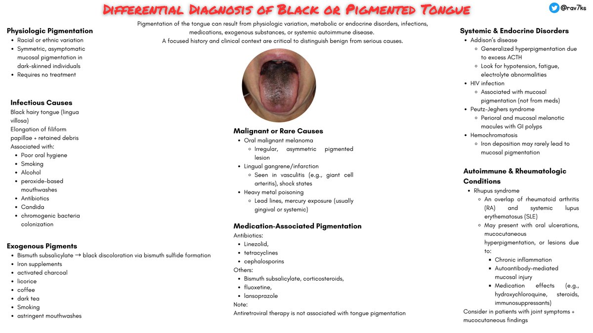 Ravi Singh (@rav7ks) on Twitter photo Black tongue isn’t always benign — don’t brush it off.
From bismuth & bacteria to melanoma & mucosal manifestations of systemic disease, the differential is broad.
🧠Here’s a high-yield infographic to guide your approach.
#MedEd #IMdocs Black tongue isn’t always benign — don’t brush it off.
From bismuth & bacteria to melanoma & mucosal manifestations of systemic disease, the differential is broad.
🧠Here’s a high-yield infographic to guide your approach.
#MedEd #IMdocs