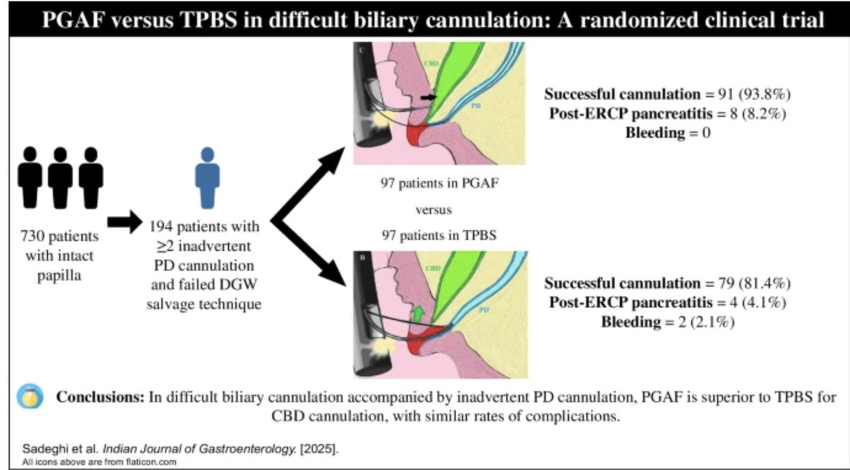 Pancreatic guidewire–assisted fistulotomy versus transpancreatic biliary sphincterotomy in difficult biliary cannulation with unintentional pancreatic duct cannulation: A randomized clinical trial

#GITwitter 

link.springer.com/article/10.100…