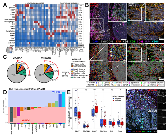 Preprint: distinct immune-response patterns between virus-positive and virus-negative Merkel cell carcinoma and their impact on metastasis and checkpoint blockade-response <a href="/Max_Haist/">Max Haist</a> <a href="/MagdaMatusiak/">Magdalena Matusiak</a> <a href="/yuqitan3/">Yuqi Tan Ph.D.</a> <a href="/GarryPNolan/">Garry P. Nolan</a> <a href="/johnhickey22/">John Hickey</a>
biorxiv.org/content/10.110…