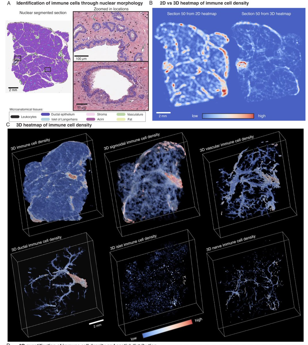 deniswirtz's tweet image. 3D imaging and nuclear morphology.
Through extension of our CODA platform, we integrate 3D imaging with nuclear segmentation to analyze nuclear morphological features in human tissue.
More here: biorxiv.org/content/10.110…
