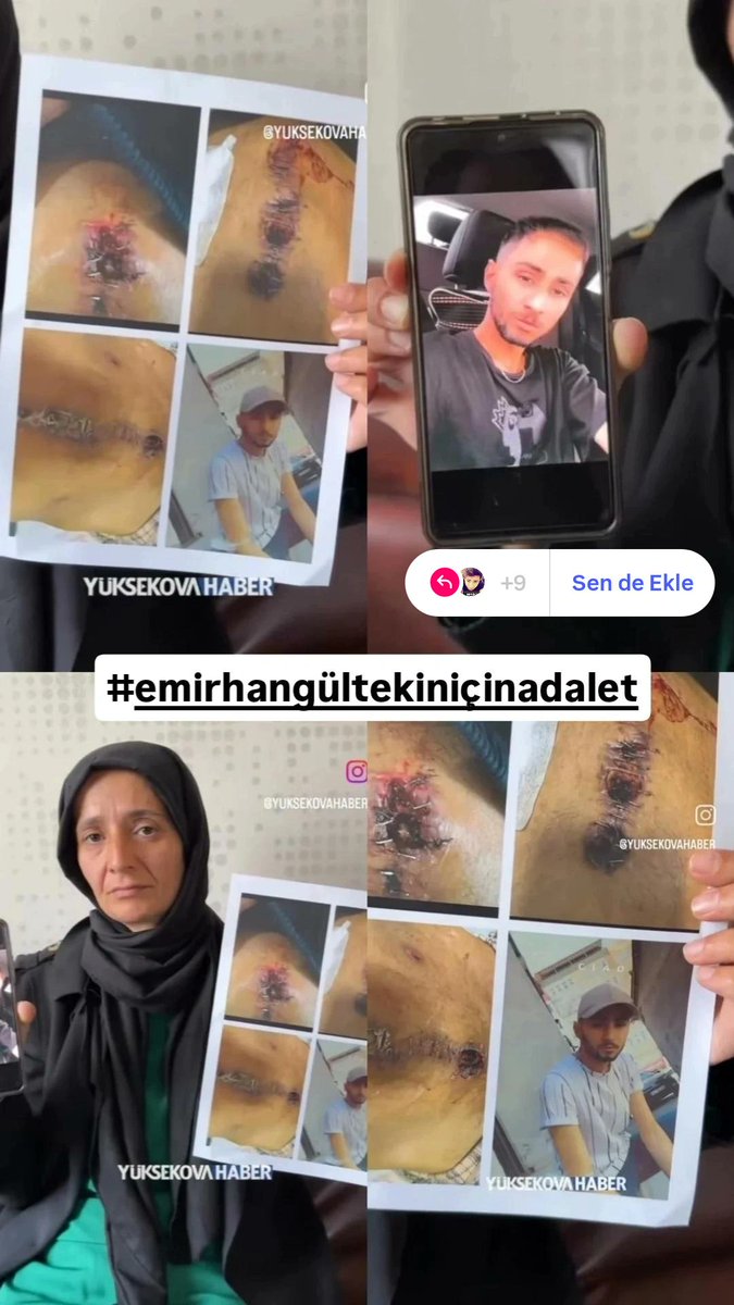 sevim Gültekin (@sevimgultekin17) on Twitter photo Sevgili duyarlı insanlarımız küçük bir apse temizleme ameliyatı bir insanı bu hale getirir mi ve maalesef yapılan bu işkencenin ismi lösemi olmuş ve oğlumun vücudunun hiçbir tarafında lösemiye dair hücre olmadığını bunlar bizden daha iyi biliyorlar yapılan bu işkencenin Sevgili duyarlı insanlarımız küçük bir apse temizleme ameliyatı bir insanı bu hale getirir mi ve maalesef yapılan bu işkencenin ismi lösemi olmuş ve oğlumun vücudunun hiçbir tarafında lösemiye dair hücre olmadığını bunlar bizden daha iyi biliyorlar yapılan bu işkencenin