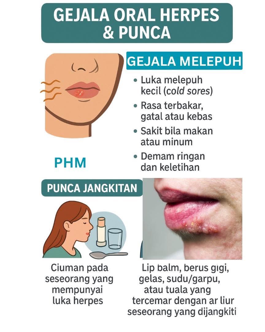 Seorang wanita datang ke klinik dengan bibir yang sakit dan melepuh. Awalnya dia sangka itu cuma ulser biasa. Tapi bila doktor periksa, ternyata ia adalah jangkitan oral herpes (HSV-1). Dia sendiri terkejut, kerana tak pernah ada luka seperti itu sebelum ini.

Thread