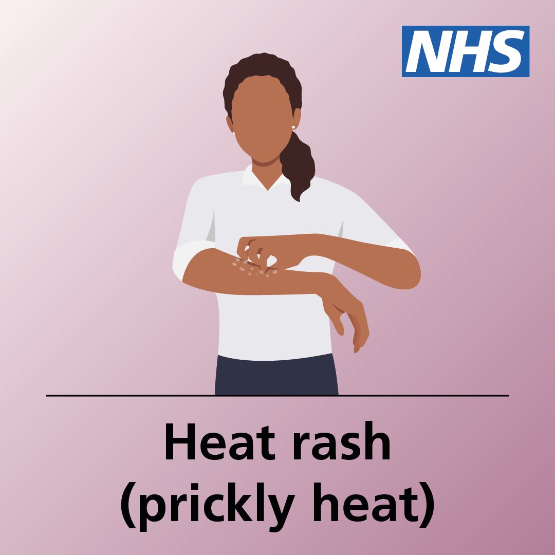 NHSuk's tweet photo. Heat rash is common during hot weather.

It is uncomfortable, but usually harmless. It usually gets better on its own after a few days.

Here are some tips to help you check if you have heat rash – and advice on how to treat it.

More info ➡️ https://t.co/fyPl8UfYgB https://t.co/3pzQIHx9Ic