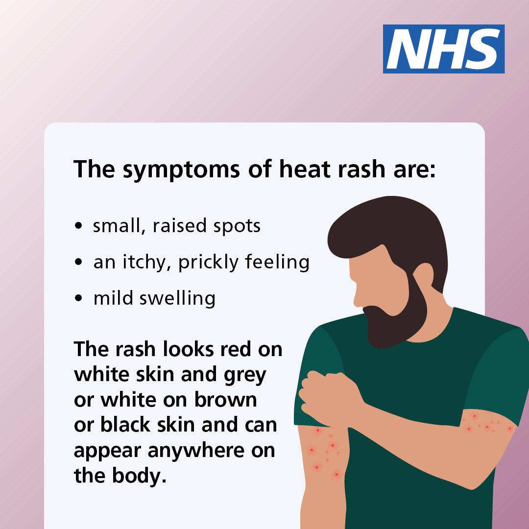 NHSuk's tweet photo. Heat rash is common during hot weather.

It is uncomfortable, but usually harmless. It usually gets better on its own after a few days.

Here are some tips to help you check if you have heat rash – and advice on how to treat it.

More info ➡️ https://t.co/fyPl8UfYgB https://t.co/3pzQIHx9Ic