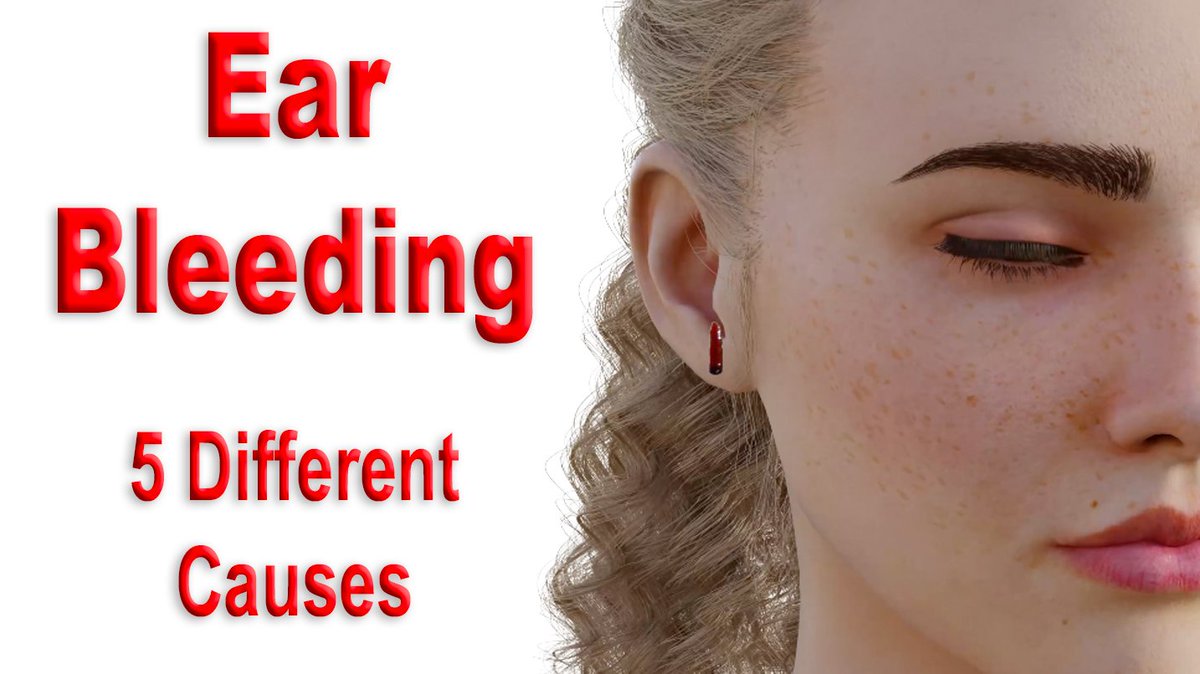 Ear Bleeding!!! 5 Different and Common Causes Shown youtu.be/MCbrVqB_w_Q
