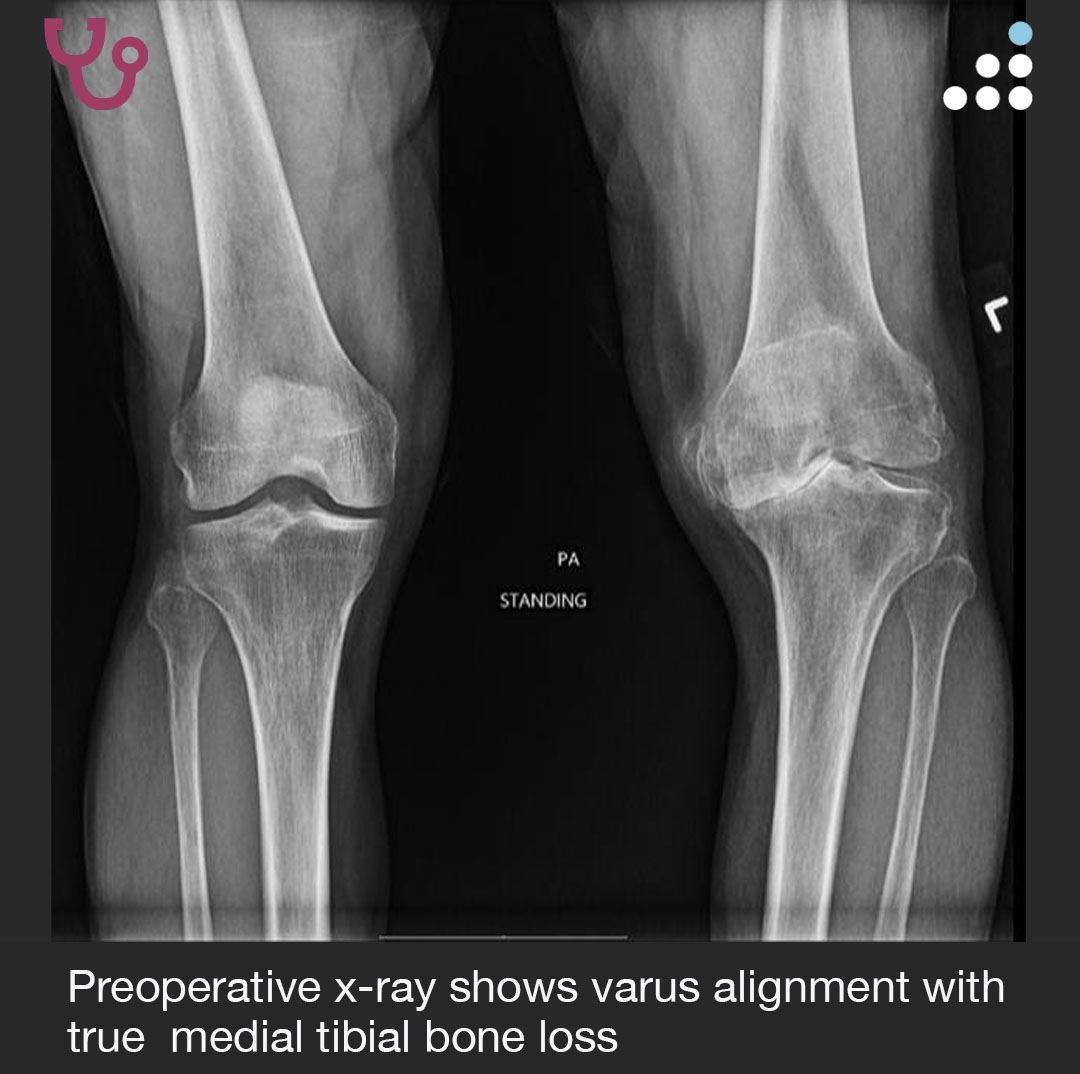 Orthobullets tweet media