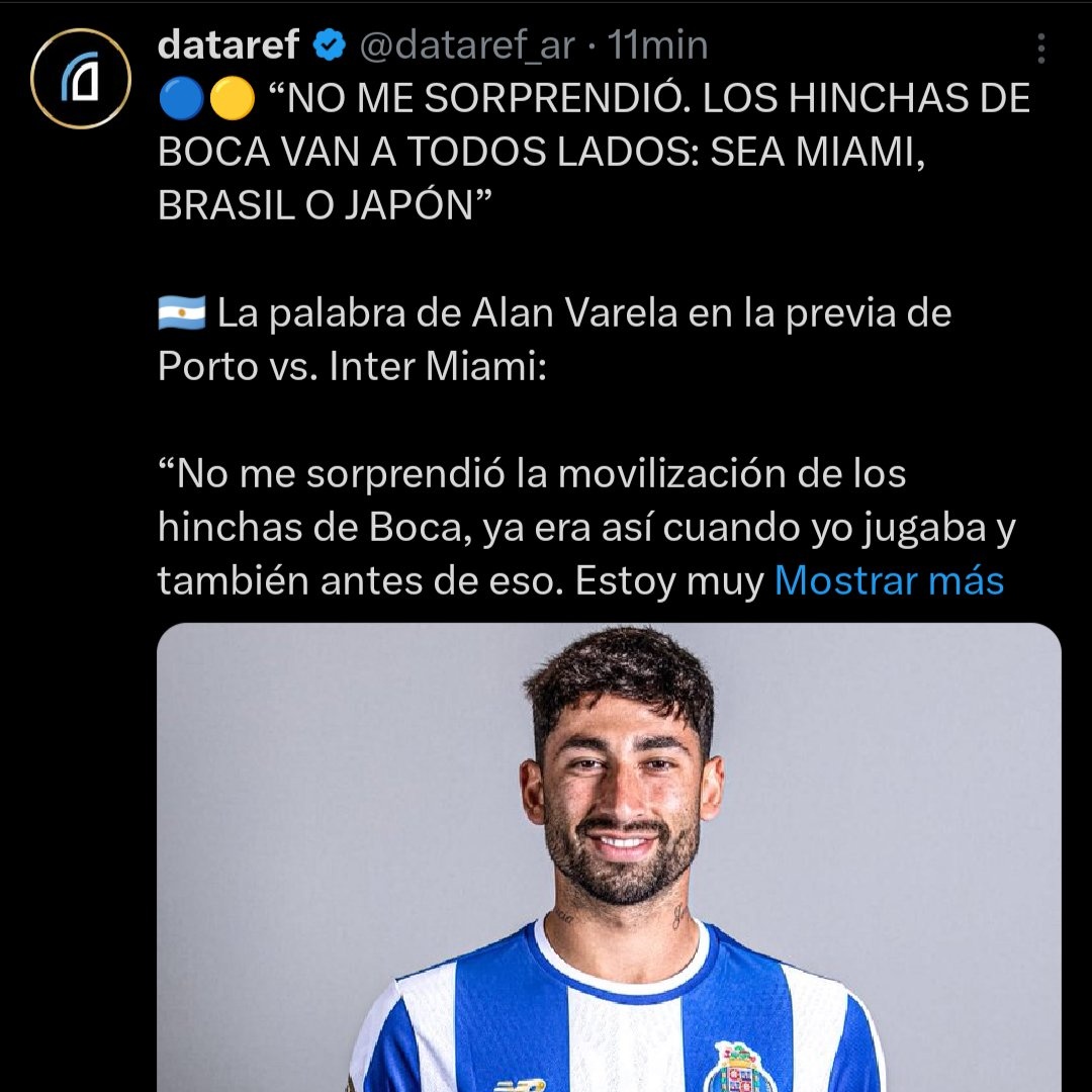 Me sorprendió / No me sorprendió