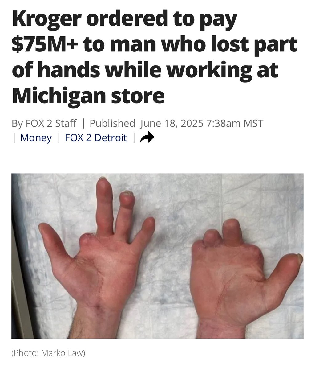 Seth_Troutt's tweet image. If you could sell your fingers for $15 million per finger how many would you sell?