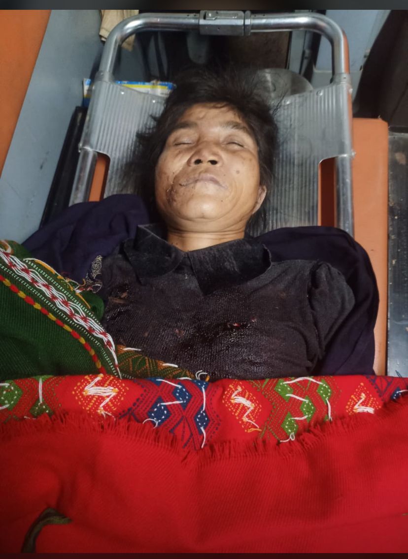 Jangmin Touthang (@jangmintouthan1) on Twitter photo June 19:The indiscriminate firing at the Kuki areas by the security forces led to the brutal killing of Mrs Hoikholhing Haokip,wife of Mr Khaikhogin Haokip,Chief of Langchingmanbi, Lamka <a href="/Spearcorps/">SpearCorps.IndianArmy</a> <a href="/adgpi/">ADG PI - INDIAN ARMY</a> <a href="/crpfindia/">🇮🇳CRPF🇮🇳</a> <a href="/LiveLawIndia/">Live Law</a> <a href="/INCIndia/">Congress</a> <a href="/BhallaAjay26/">Ajay Bhalla</a> <a href="/the_hindu/">The Hindu</a> June 19:The indiscriminate firing at the Kuki areas by the security forces led to the brutal killing of Mrs Hoikholhing Haokip,wife of Mr Khaikhogin Haokip,Chief of Langchingmanbi, Lamka <a href="/Spearcorps/">SpearCorps.IndianArmy</a> <a href="/adgpi/">ADG PI - INDIAN ARMY</a> <a href="/crpfindia/">🇮🇳CRPF🇮🇳</a> <a href="/LiveLawIndia/">Live Law</a> <a href="/INCIndia/">Congress</a> <a href="/BhallaAjay26/">Ajay Bhalla</a> <a href="/the_hindu/">The Hindu</a>