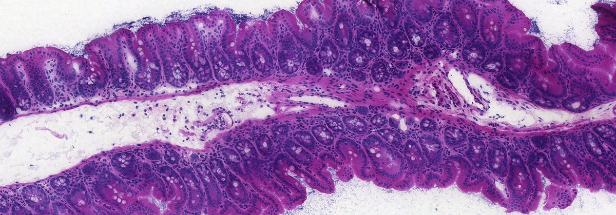 NCCRMicrobiomes's tweet image. 🌱🦠Gardening in the gut: Tackling antibiotic resistant bacteria with vaccines and friendly bacteria
How a microbiome-centric approach can help fight antibiotic resistant infections
👇
globalhealthnow.org/2025-06/garden…