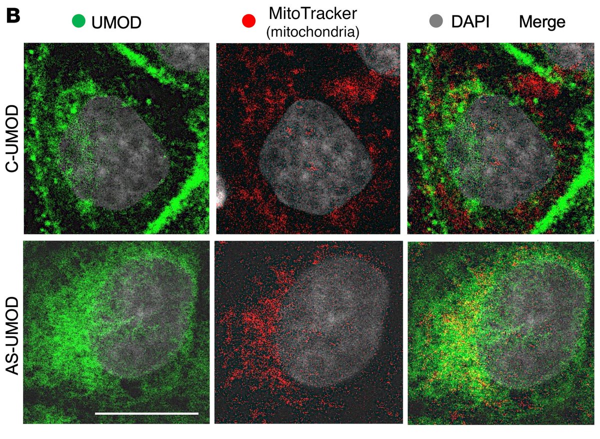 ASCI (@the_asci) on Twitter photo Kidney cells can protect themselves during injury, but the mechanisms were unclear.
ASCI member Tarek M. El-Achkar <a href="/AshkarLab/">Tarek M. Ashkar (El-Achkar)</a> & team <a href="/IUMedSchool/">IU School of Medicine</a> now show that oxidative stress induces an isoform of uromodulin that re-routes to the mitochondria to enhance energy production. Kidney cells can protect themselves during injury, but the mechanisms were unclear.
ASCI member Tarek M. El-Achkar <a href="/AshkarLab/">Tarek M. Ashkar (El-Achkar)</a> & team <a href="/IUMedSchool/">IU School of Medicine</a> now show that oxidative stress induces an isoform of uromodulin that re-routes to the mitochondria to enhance energy production.