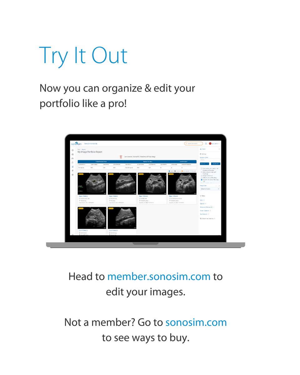 Need to free up space or tidy your saved images in the SonoSimulator? Follow these quick tips to delete images through My Image Portfolio Report or the Review feature. Keep in mind: once images are deleted, they’re gone for good! 💻

bit.ly/4e7Dksr

#sonosim #ultrasound