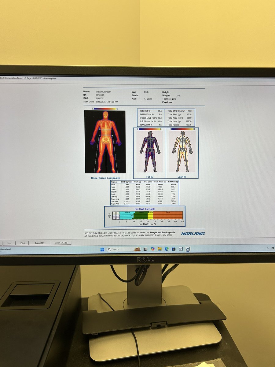 Got on the DXA at Kentucky, 235 body weight with 200 pounds lean muscle at 11.2% Body fat. bone density of 1.18