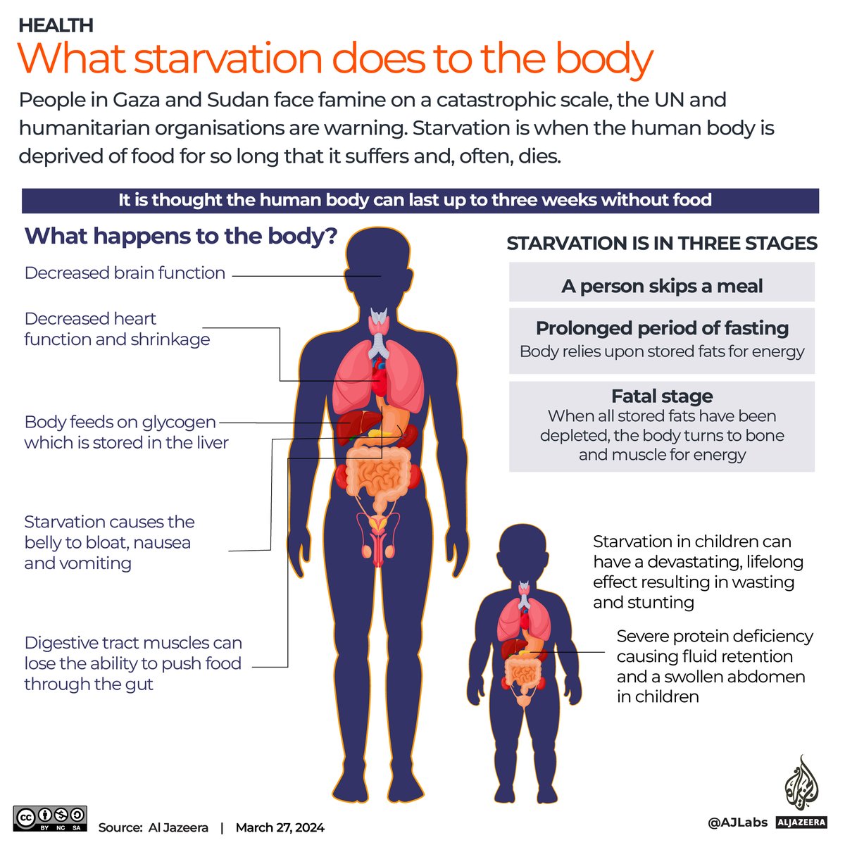 Over 5,100 Palestinian children were treated for malnutrition in Gaza in May, UNICEF says, warning of an “alarming” rise as Israel continues to block most aid from entering the war-torn territory.

🔴 LIVE updates: aje.io/ez2sq6