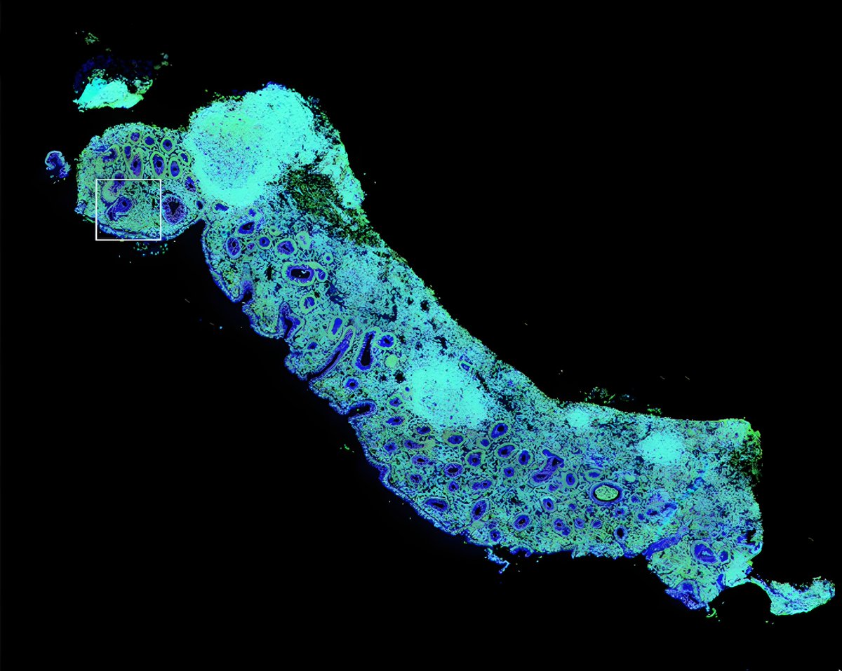abcam's tweet image. Discover a newly developed and validated antibody panel, tested across four distinct human tissue types.
When integrated with the Cell DIVE™ multiplexed imaging platform, this panel enables in-depth analysis of cell-cell interactions and multi-marker colocalization, offering…