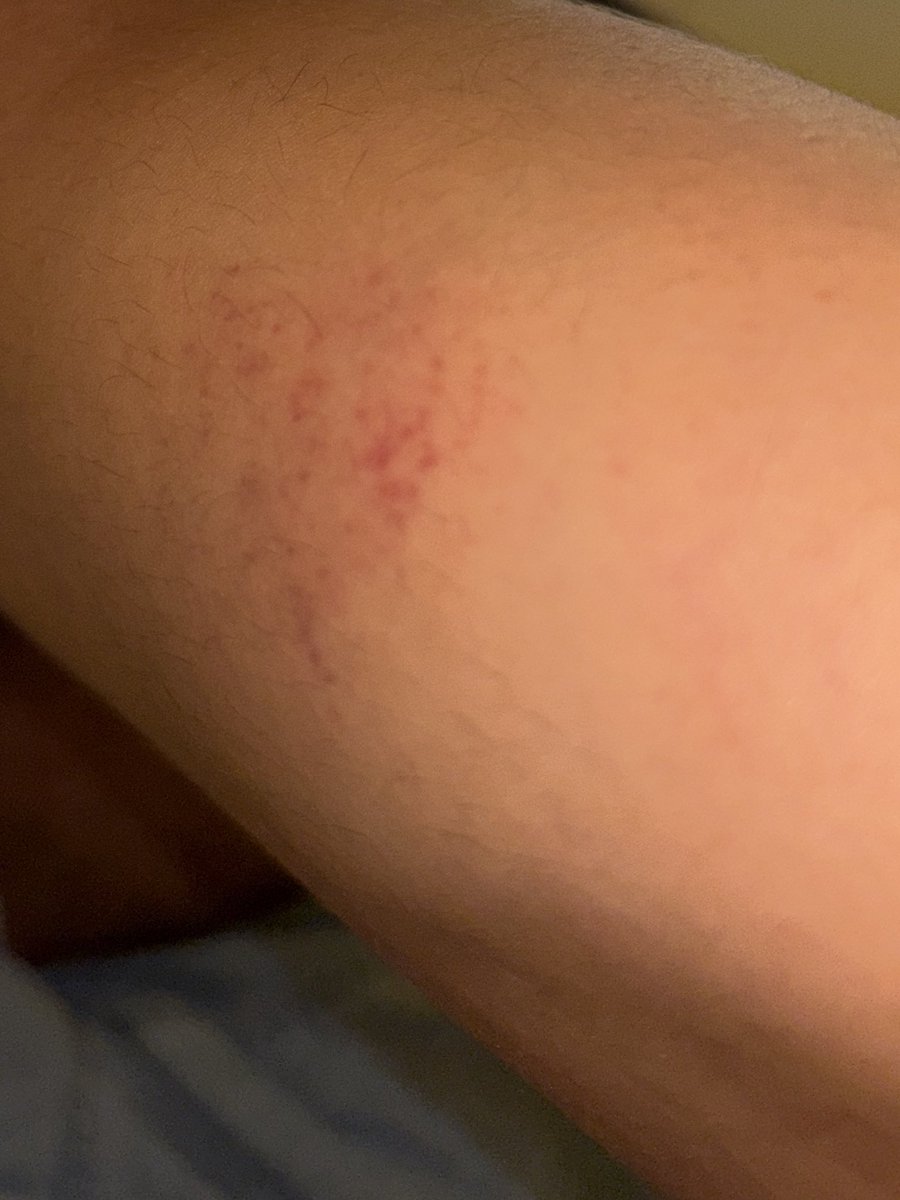 adaroux jadore les fenêtres tweet media