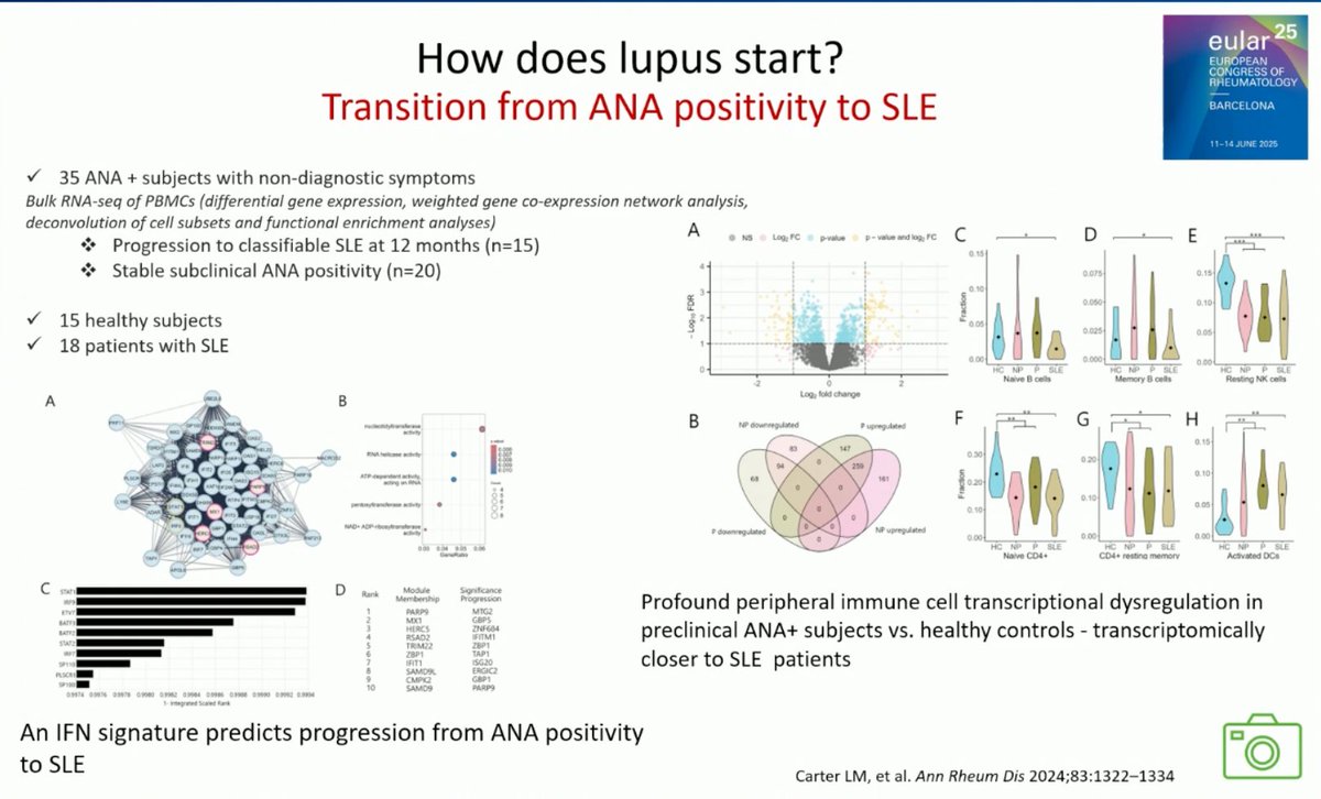 lupus_hub's tweet image. CONGRESS | #EULAR2025 | PLENARY SESSION
Antonis Fanouriakis, National and Kapodistrian University of Athens, gave a talk about recent advances in #SLE including pathogenesis, treatment strategy and major clinical trials in 2024-2025.
· Genetic burden of SLE may lead to…