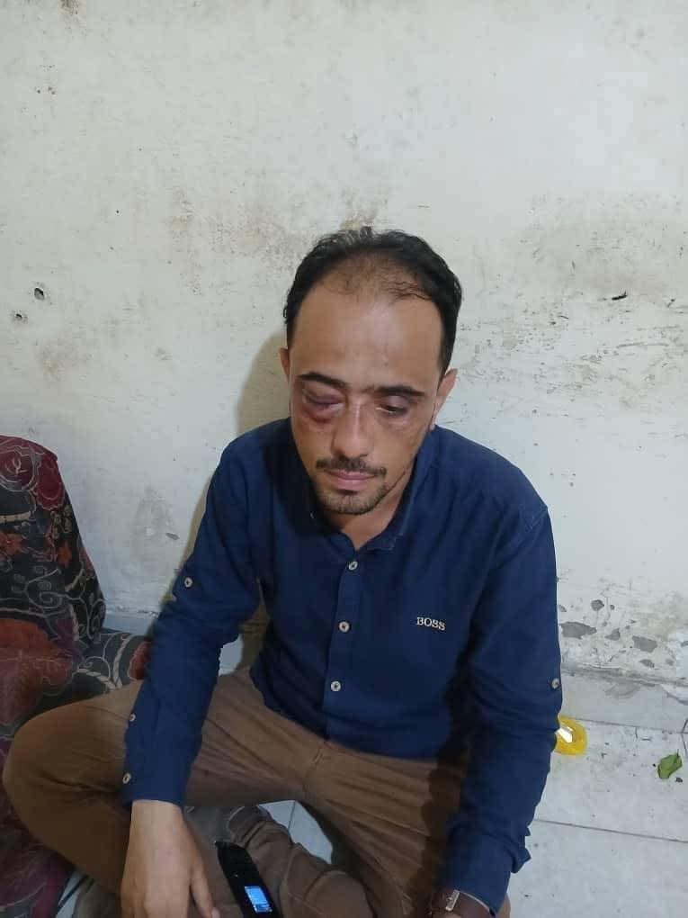 #تعز نجل قائد محور تعز يختطف رجل أعمال ويعتدي عليه بوحشية ويسحله إلى تحت أقدام تاجر.. اخر