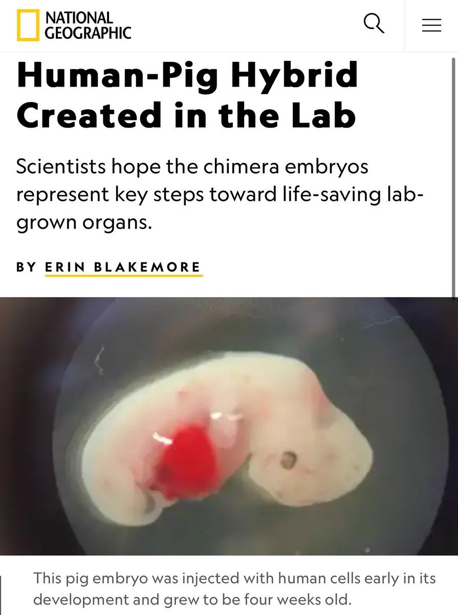 Scientists hope pig/human combos are the future.