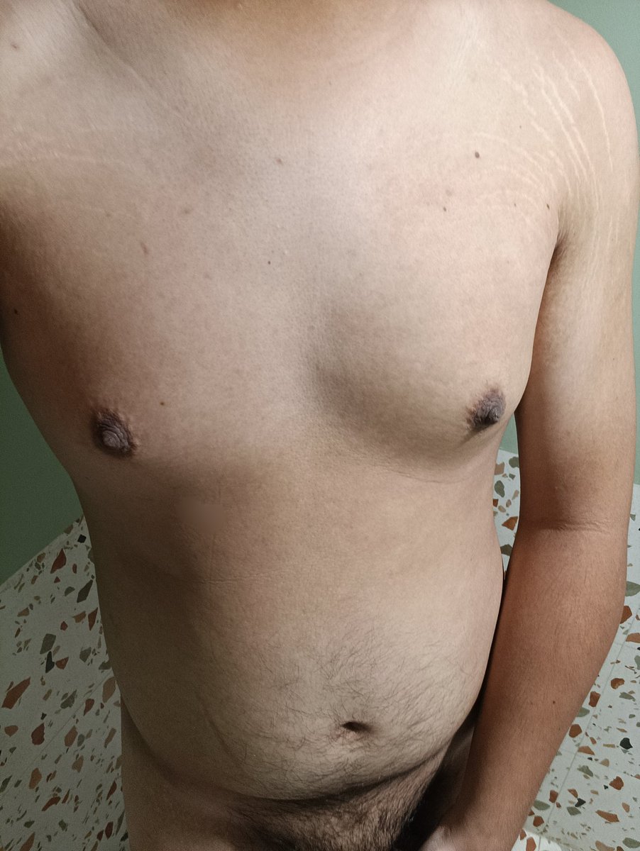 nipple feeder tweet media