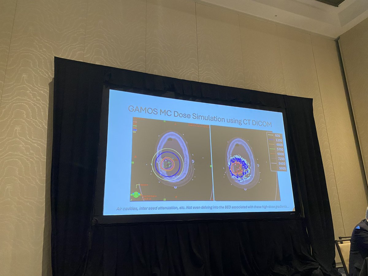 #ABSBrachy25 new technologies EM tracking, AI enhanced treatment planning, gammatile for CNS, skin applications &amp; radiopharmaceuticals with demonstrated support from <a href="/ASTRO_org/">ASTRO</a>  president <a href="/SameerKeoleMD/">Sameer Keole</a> #ThisIsBrachytherapy