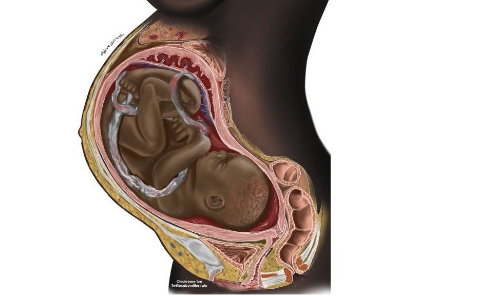 Picture of Black Unborn Baby Goes Viral for Showing Black Unborn Children in the Womb buff.ly/Wd48gY7