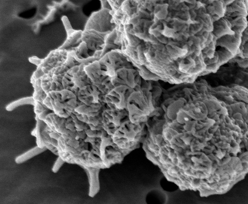 fpu_kaiyo's tweet image. 【論文掲載】ミクロの世界に新たなグループ！植物プランクトン「パルマ藻」の未知なる姿を解明

海洋生物資源学科の佐藤晋也教授の研究チームは、パルマ藻という藻類のグループから新種を発見し、あわせて新たな目、科、属を提唱しました！

onlinelibrary.wiley.com/doi/10.1111/jp…

（海洋）

#福井県立大学 #FPU