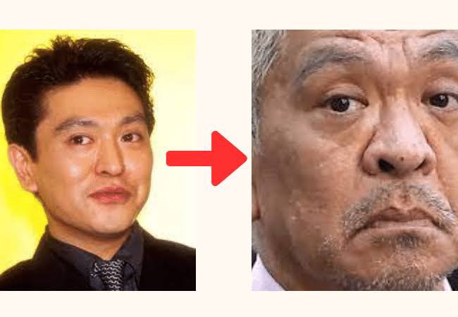 pankopankogooo's tweet photo. 年取ると鼻が��きくなるのが怖い人へ

原因は骨の老化・萎縮だよ。
40代からエストロゲンが減少して骨密度と質が低下していくから、エストロゲンと似た働きをするエクオールをサプリでとって鼻の肥大化を抑えよう！

奇跡の51歳美容家さきめぐさんが、骨のために毎日とってると言ってから説得力あった https://t.co/0F1OK2lP1h