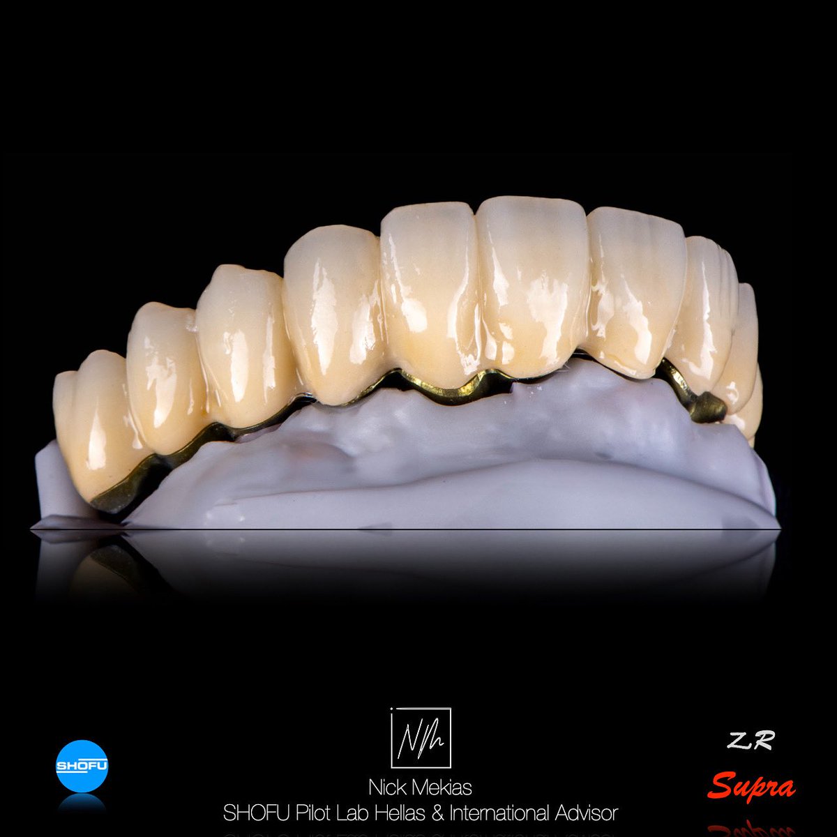 NikosMekias's tweet image. Innovation &amp;amp; Precision in Dental Prosthetics: In-house milled titanium bar, Monolithic SHOFU Supra Zirconia stained for posterior, SHOFU Vintage ZR layered on anterior six. Advanced tech &amp;amp; craft for reliable results. #DentalArt #TitaniumBar #ZirconiaProsthetics #nikosmekias