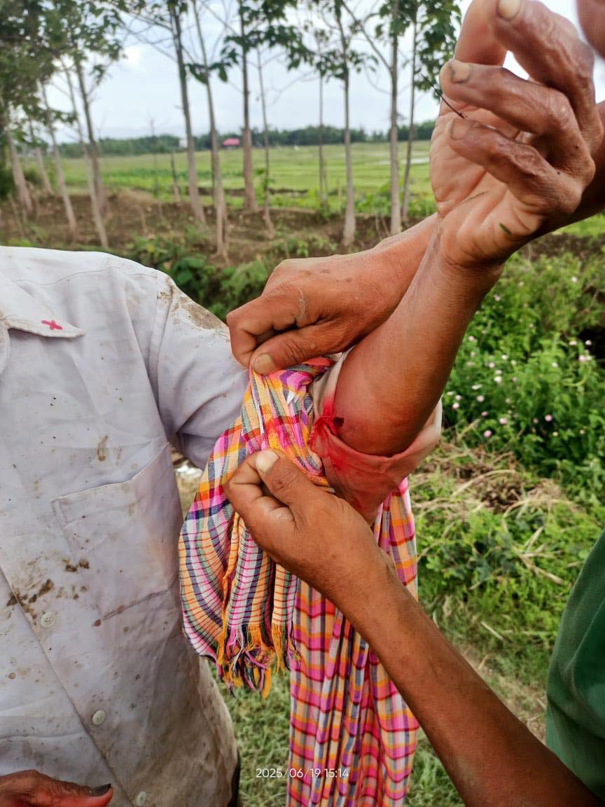 VladAdiReturns's tweet photo. Elderly farmer Biren Singh was shot by suspected Church-backed #KukiTerrorists while farming his land in Phubala village on 18.06.2025

The attack came 2 days after #Manipur Police denied reports of firing by Christian Kukis in this region
cntd..
@hindupost @HinduHate @AskAnshul https://t.co/pKv7c2evIz