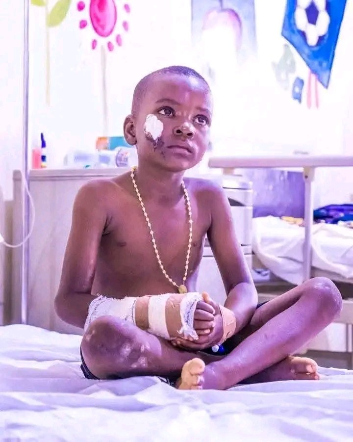IortyerTimothy's tweet photo. Some of the children who survived the Yelewata attack by Fulani herdsmen in BENUE State 

Unfortunately some were burnt beyond recognition. https://t.co/GVTCiQraes