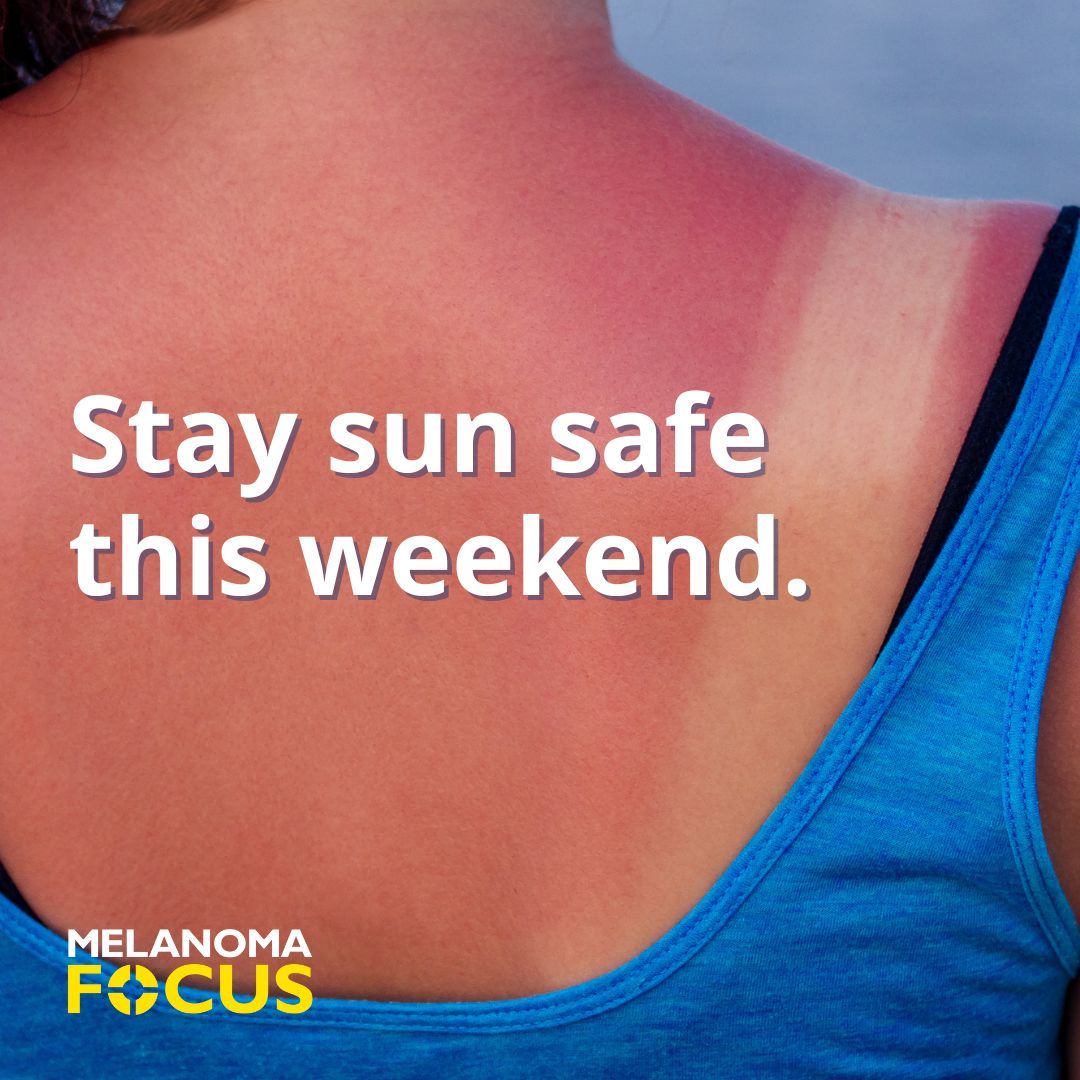 Please remember to stay sun safe this weekend.☀️ 

🧴 Use UVA &amp; UVB protection: SPF 30+ &amp; 5 stars remember to reapply
☀️ Avoid the midday sun (between 11am to 3pm)
👒Wear a wide-brimmed hat and protect the skin with clothing
🕶 Protect your eyes with UV protected sunglasses